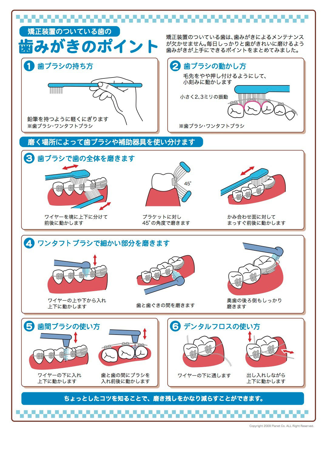 ブラケットのついた歯の磨き方