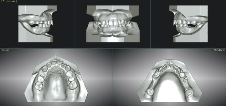 バーチャル模型